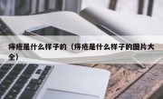 痔疮是什么样子的（痔疮是什么样子的图片大全）