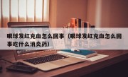 眼球发红充血怎么回事（眼球发红充血怎么回事吃什么消炎药）