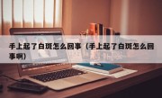 手上起了白斑怎么回事（手上起了白斑怎么回事啊）