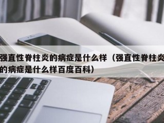 强直性脊柱炎的病症是什么样（强直性脊柱炎的病症是什么样百度百科）